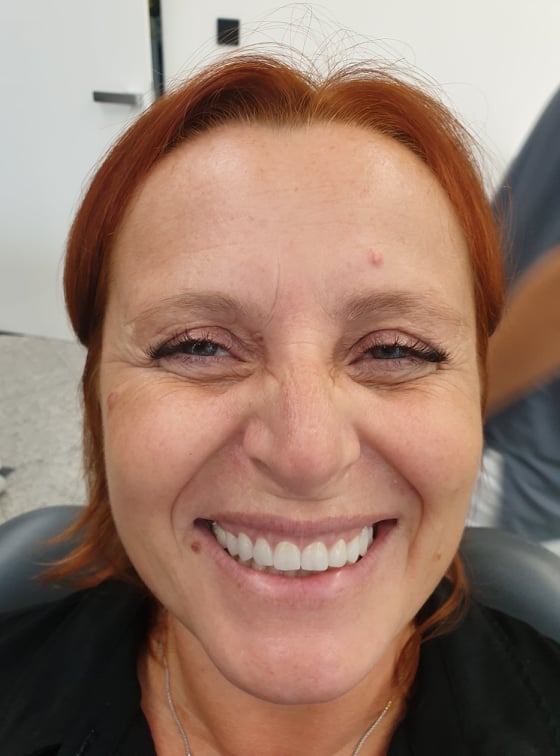 Sreca Sa Novim Zubima 